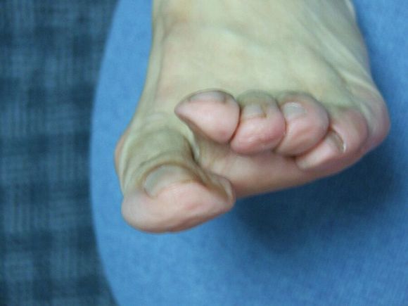 时尚潮流下的新宠，叠趾鞋的魅力展现