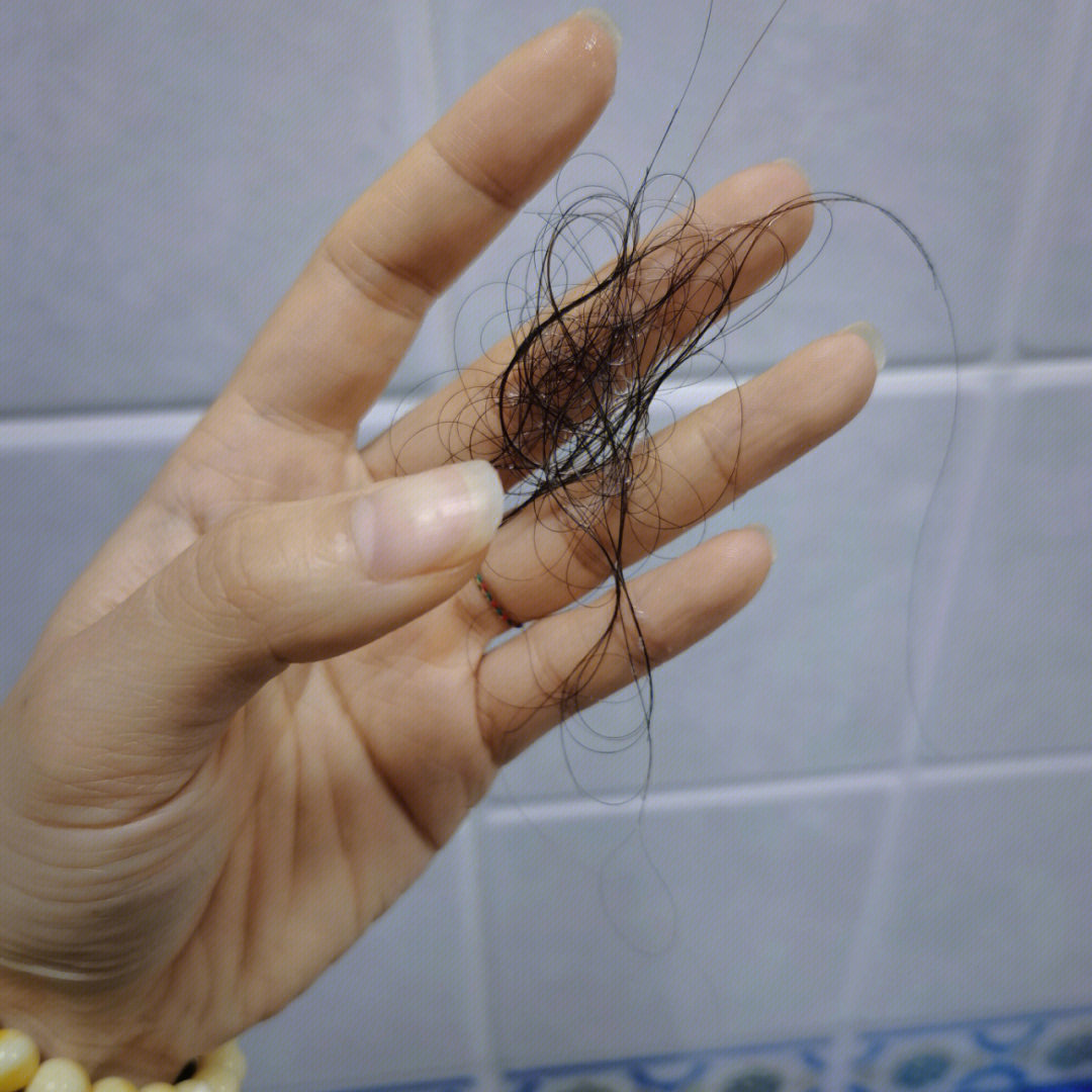 新一代智能防脱科技重塑秀发风采,告别掉发的烦恼,重塑自信风采