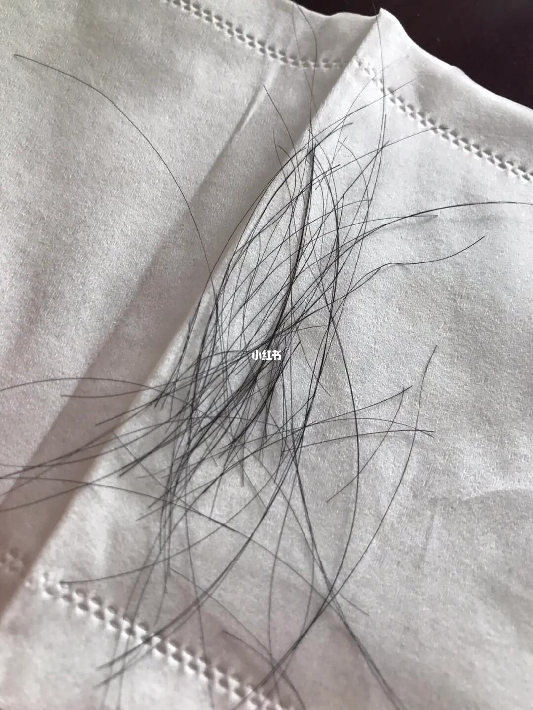 新一代智能防脱科技重塑秀发风采,告别掉发的烦恼,重塑自信风采