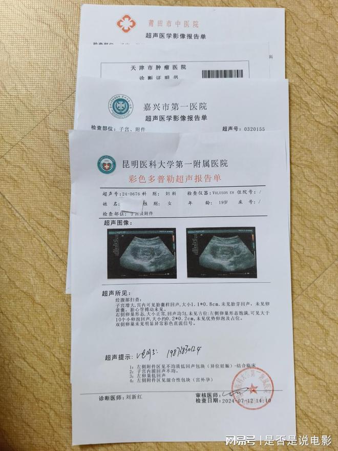 最新确诊病假,理解、处理与关怀的重要性