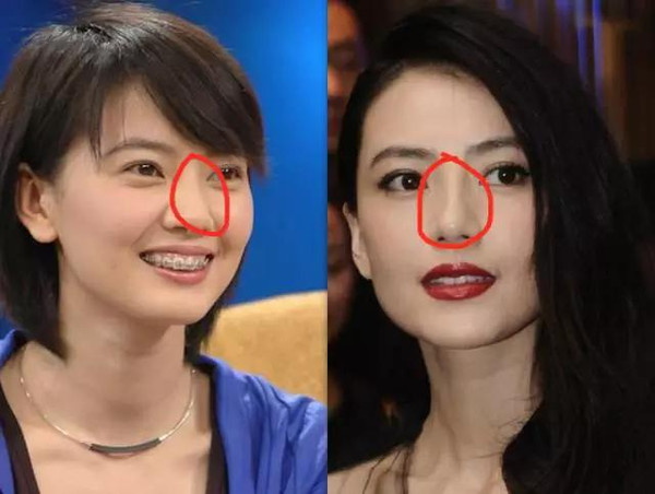 山根低的明星,星光熠熠,魅力不减