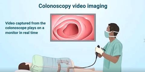 肠镜价格详解,了解与支付流程的全方位指南