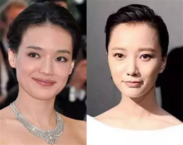 探究明星不植发的原因与选择指南