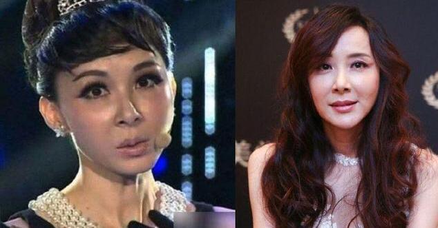 玻尿酸明星,科技重塑美丽,开启新纪元的光辉之路