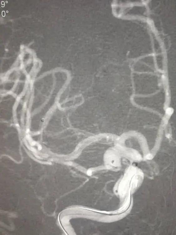 河南省最新病例情况与应对步骤指南